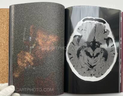 Yusuke Takagi,SPIN Yusuke Takagi,SPIN