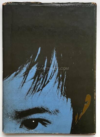 Tadao Mitome,Document : Shonimahi no kiroku / Document : Record of Infantile paralysis