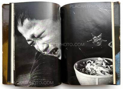 Tadao Mitome,Document : Shonimahi no kiroku / Document : Record of Infantile paralysis