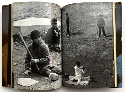 Tadao Mitome,Document : Shonimahi no kiroku / Document : Record of Infantile paralysis