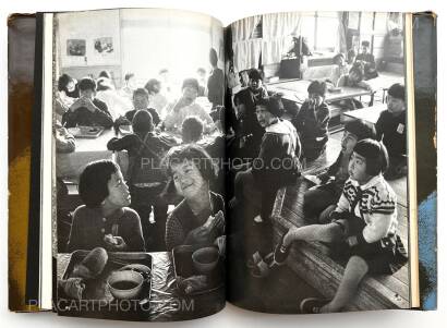 Tadao Mitome,Document : Shonimahi no kiroku / Document : Record of Infantile paralysis