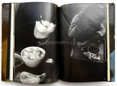 Tadao Mitome,Document : Shonimahi no kiroku / Document : Record of Infantile paralysis