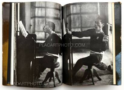 Tadao Mitome,Document : Shonimahi no kiroku / Document : Record of Infantile paralysis