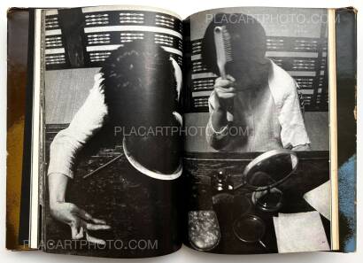 Tadao Mitome,Document : Shonimahi no kiroku / Document : Record of Infantile paralysis