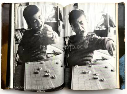 Tadao Mitome,Document : Shonimahi no kiroku / Document : Record of Infantile paralysis
